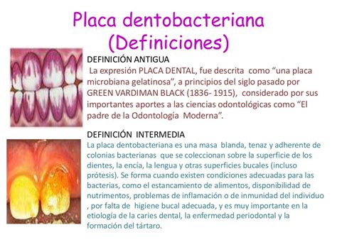 placa dentobacteriana - placa de pvc 3d
